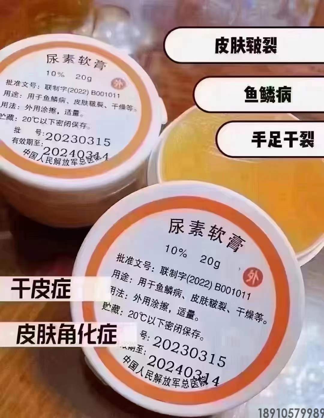 尿素软膏